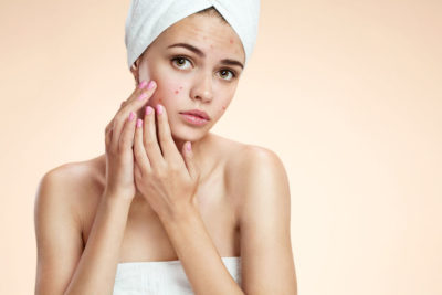 acne treatments at top clinic near me